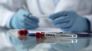 Suspeita de Ebola é descartada em pacientes no Rio e em SP: o que se sabe