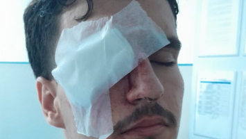 Jovem atingido por bala de borracha no Maracanã perde visão de um olho e fará cirurgia; mãe critica ação policial