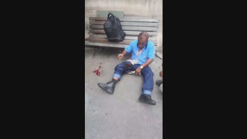 Feridos em explosão de bomba caseira na Ilha do Governador recebem alta